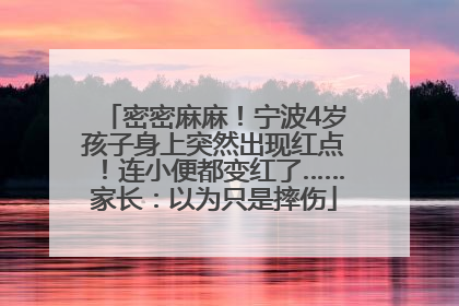 密密麻麻！宁波4岁孩子身上突然出现红点！连小便都变红了……家长：以为只是摔伤